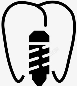 牙科植入物前磨牙植入物螺钉口腔图标高清图片