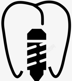 伪造前磨牙植入物螺钉口腔图标高清图片