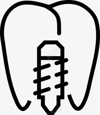 前磨牙植入物牙齿螺钉图标图标