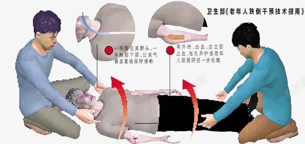 处理骨折png免抠素材_新图网 https://ixintu.com 骨折 骨折处理