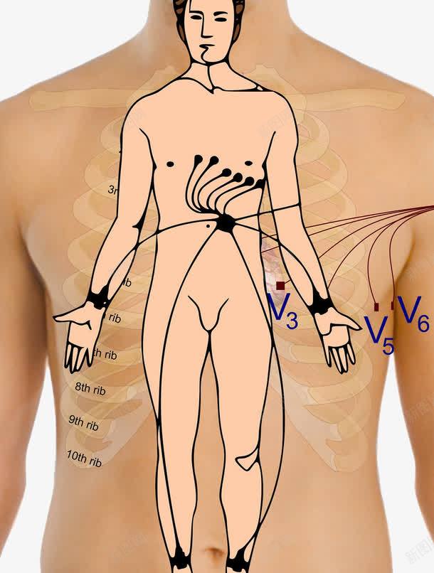 心电图示意图png免抠素材_新图网 https://ixintu.com 人体 医学 心电图 示意图