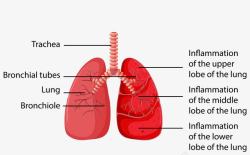 肺部图素材