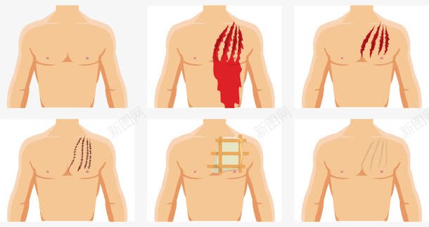 伤口png免抠素材_新图网 https://ixintu.com 伤口 纱布