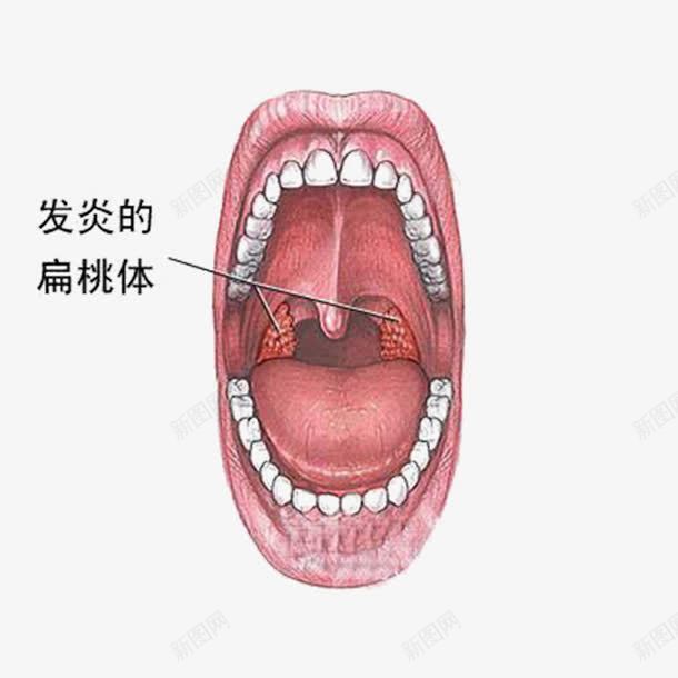 癌症的病变png免抠素材_新图网 https://ixintu.com 不要抽烟 多吃淀粉类食物 心态平衡 科学运动 远离辐射 预防癌症