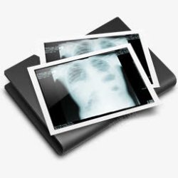 xray文件夹胸部X射线撬黑高清图片