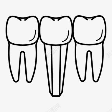 牙种植体基牙陶瓷图标图标