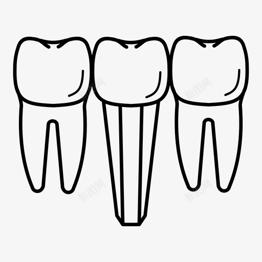 牙种植体基牙陶瓷图标svg_新图网 https://ixintu.com 基牙 牙种植体 牙科诊所 牙齿 陶瓷