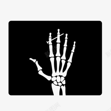 x射线事故手指图标图标