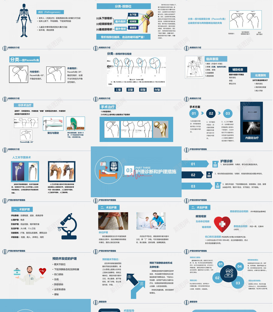 卡通简约风医学股骨颈骨折护理查房PPT模板_新图网 https://ixintu.com 医学 卡通 护理 查房 简约 股骨 颈骨 骨折