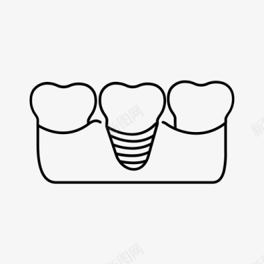牙科植入物牙桥牙科护理图标图标