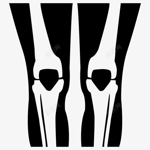 膝关节骨关节骨图标svg_新图网 https://ixintu.com 人造 假体 医用 植入物 膝关节 身体 部位 骨关节 骨科 骨骼