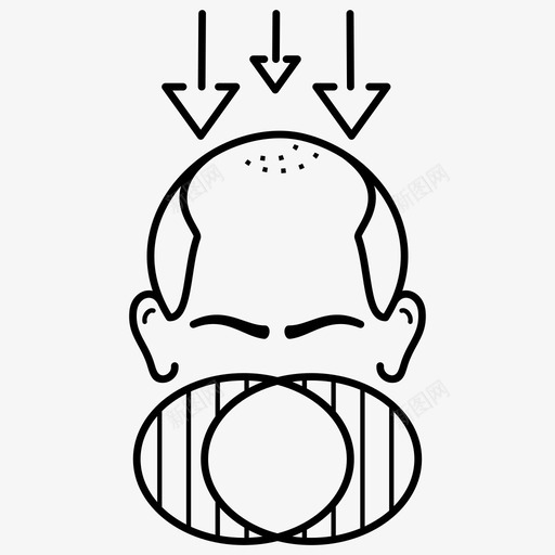 雄激素性脱发脱发男性图标svg_新图网 https://ixintu.com 掉发 毛发学 男性 症状 脱发 阶段 雄激素性脱发