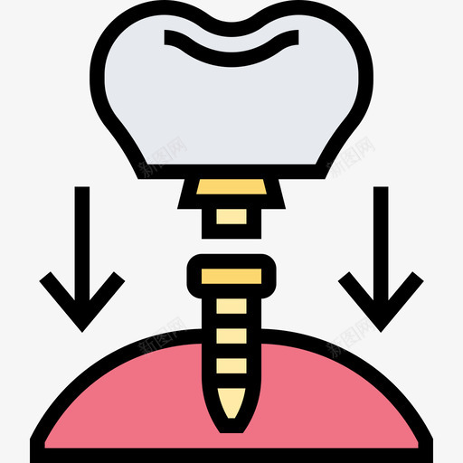 牙种植体牙19线性颜色图标svg_新图网 https://ixintu.com 植体 牙种 种植牙 线性 颜色