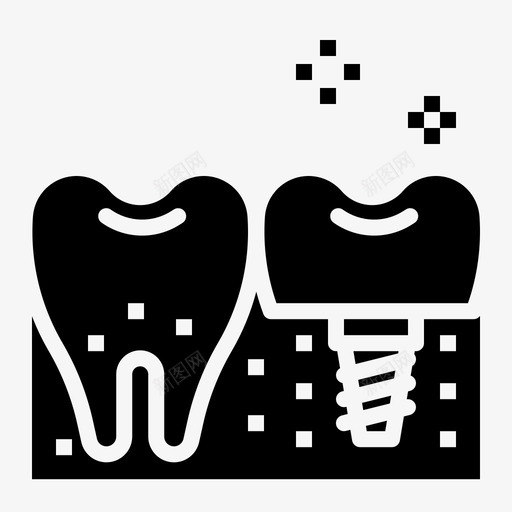 植入物牙科44实心图标svg_新图网 https://ixintu.com 实心 植入物 牙科