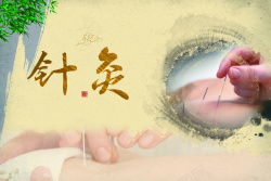 传统针灸中医海报背景高清图片