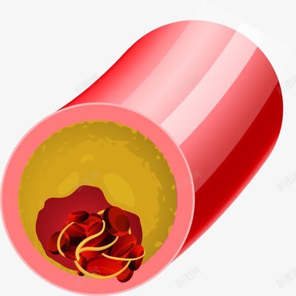 血管里的红细胞png免抠素材_新图网 https://ixintu.com 红细胞 红色血管 细胞 血管