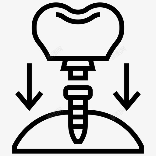 植入物牙科医疗图标svg_新图网 https://ixintu.com 医疗 植入物 牙科 牙齿