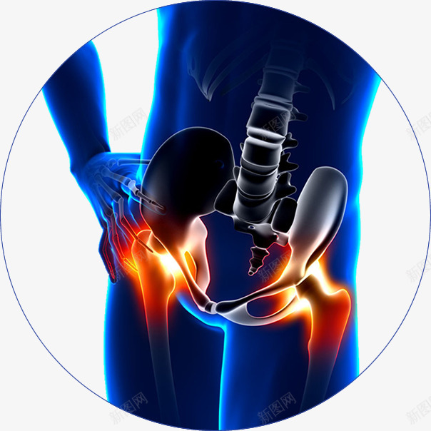 坐骨神经痛骨骼腰椎疼痛透明图png免抠素材_新图网 https://ixintu.com 坐骨 坐骨神经 神经痛 骨骼 腰椎 疼痛 透明图