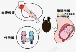血液传播乙肝传播途径高清图片