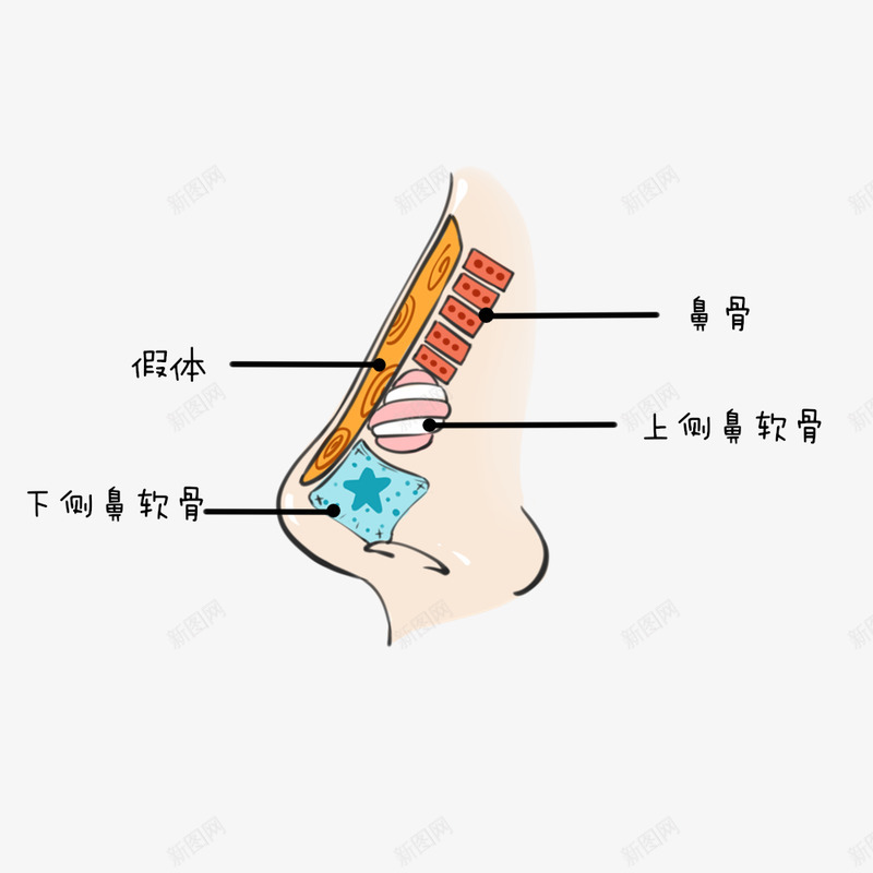 隆鼻假体隆鼻硅胶假体硅胶膨体png免抠素材_新图网 https://ixintu.com 隆鼻 假体 硅胶 膨体