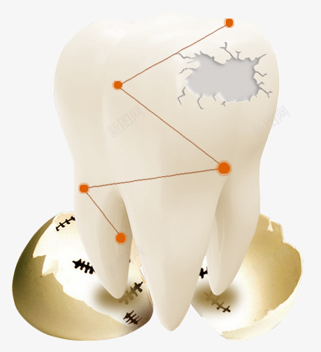 补牙png免抠素材_新图网 https://ixintu.com 补牙