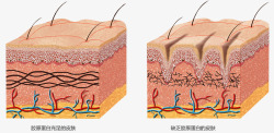 鱼尾纹舒展术素材