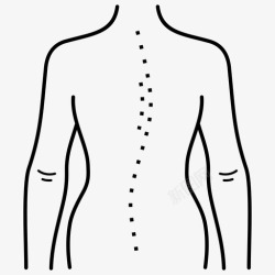 前凸体位缺陷脊柱脊柱前凸高清图片