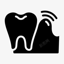牙龈炎牙龈炎牙科牙龈高清图片
