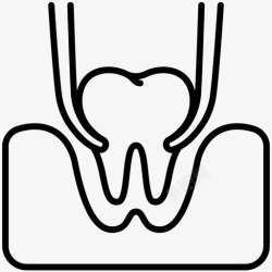 拔除拔牙拔除治疗高清图片