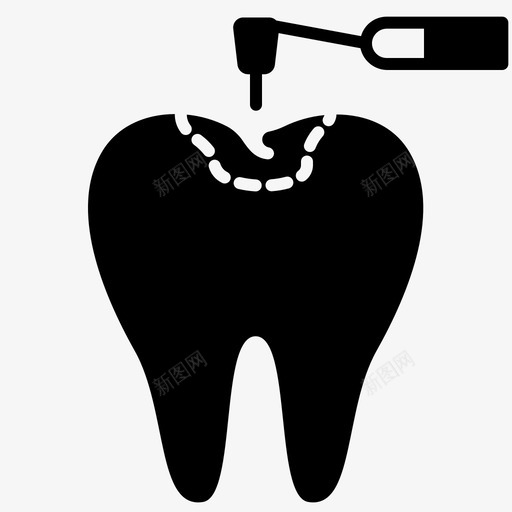 牙科充填医疗牙齿svg_新图网 https://ixintu.com 牙科 充填 医疗 牙齿 治疗 固体