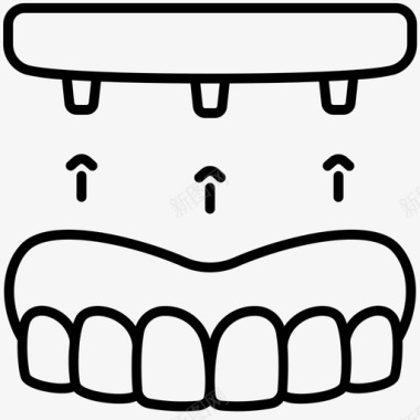 义齿植入物牙科螺钉图标