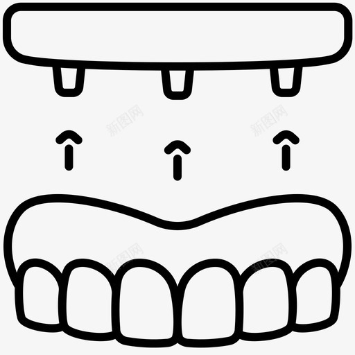 义齿植入物牙科螺钉svg_新图网 https://ixintu.com 义齿 植入物 牙齿 牙科 螺钉 轮廓