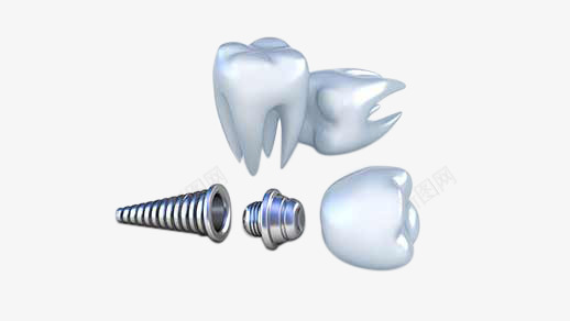 种植牙2 518 292医疗素材png免抠素材_新图网 https://ixintu.com 种植 牙医 医疗 素材