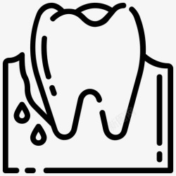 牙周炎牙周炎牙科口腔科高清图片