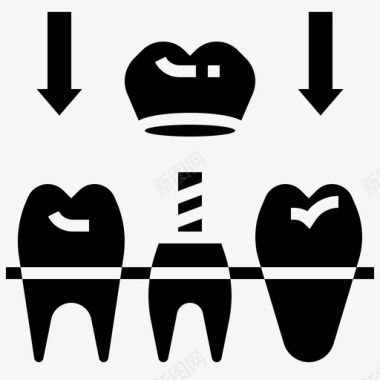 牙冠帽植入物图标