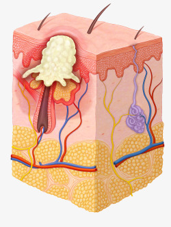皮肤层 细胞素材