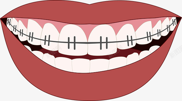 牙齿矫正 微笑 牙齿 牙医 牙科 口 装置 图标 图透明png免抠素材_新图网 https://ixintu.com 牙齿 矫正 微笑 牙医 牙科 装置 图标 标图 透明