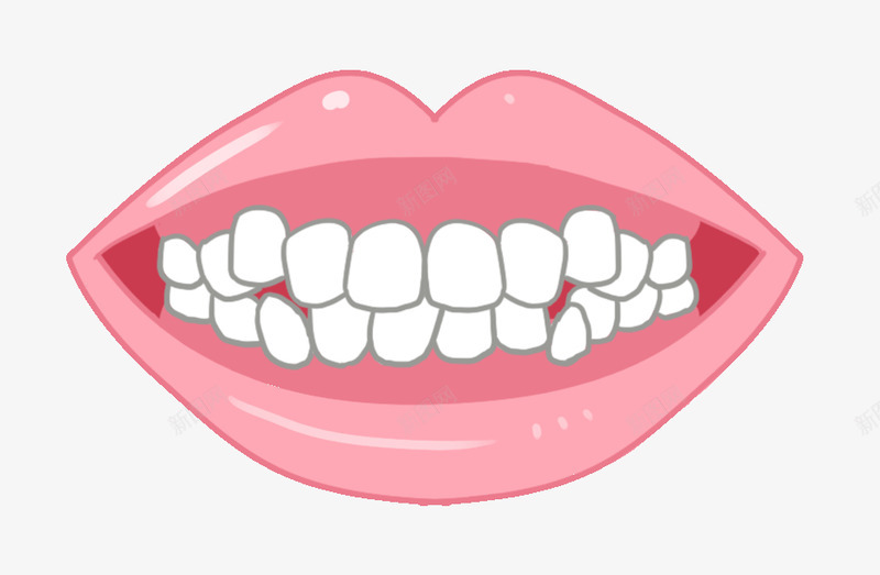 牙列拥挤牙齿不齐牙齿png免抠素材_新图网 https://ixintu.com 牙齿 牙列 拥挤 不齐