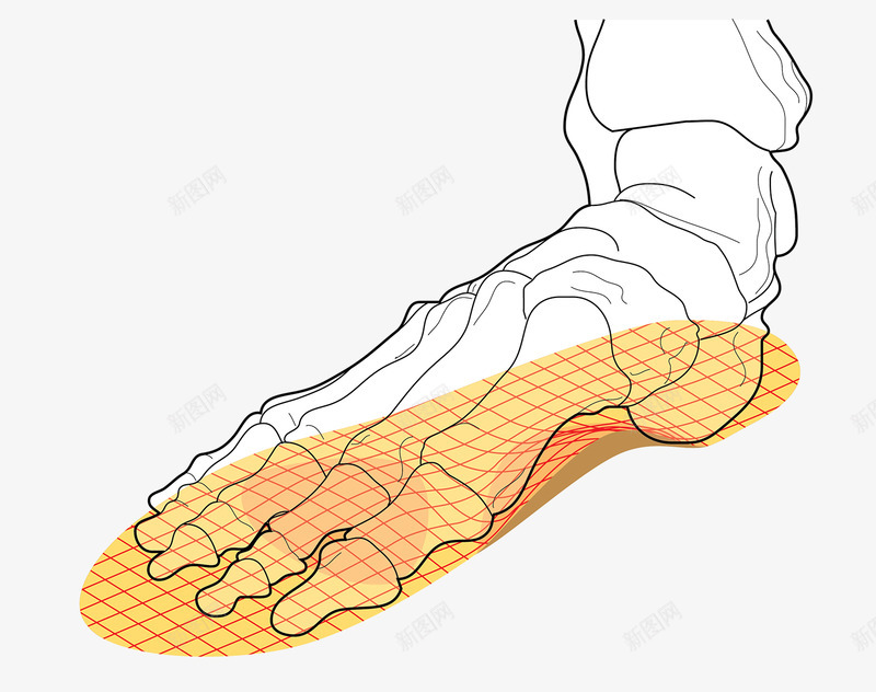 Tech illustration of metatarsal and shoe insole insertsX  鞋科技png免抠素材_新图网 https://ixintu.com 科技