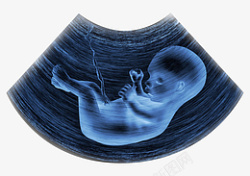 彩超彩超检查胎儿高清图片