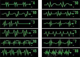 心电监护仪心电图线条png免抠素材_新图网 https://ixintu.com 心电监护仪 心电图 医疗设备 身体检查 心跳折线 医疗仪器 卡通图标 心跳线图 绿色线条