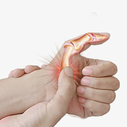 手疼手指腱鞘炎腱鞘疼痛高清图片