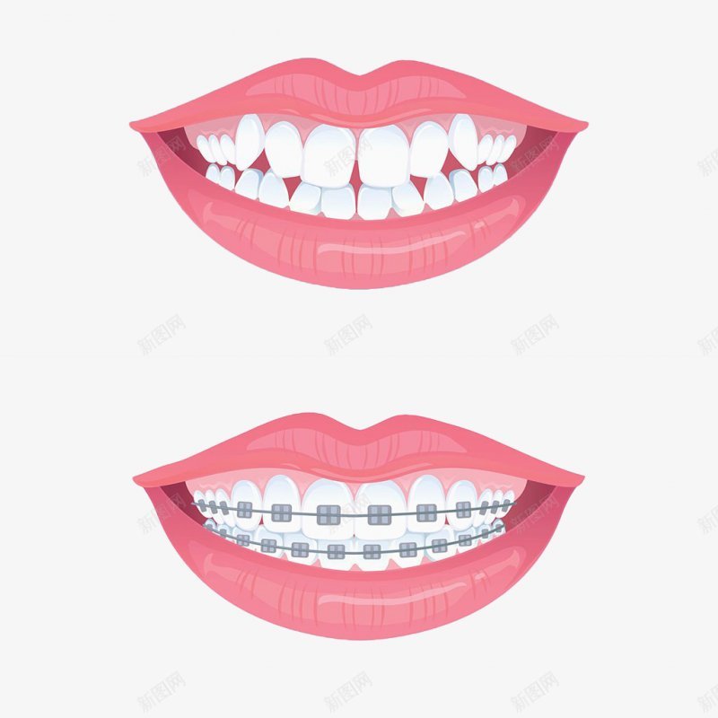 牙齿嘴牙齿牙齿png免抠素材_新图网 https://ixintu.com 嘴 牙齿 牙齿牙齿