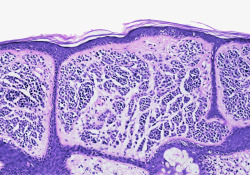 皮层组织显微镜下的皮肤组织高清图片