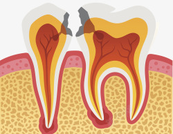 神经末梢牙齿护理教科书插图高清图片
