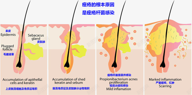 毛囊细胞生长图png免抠素材_新图网 https://ixintu.com 教学插图 毛孔 生物学 皮肤结构