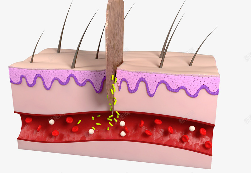 皮肤组织横切面png免抠素材_新图网 https://ixintu.com 毛囊 皮层组织 皮肤结构 血管