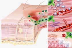 白细胞皮肤炎症抗体高清图片