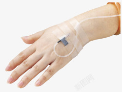 静脉输液管输液袋女性手上静脉注射的输液管高清图片