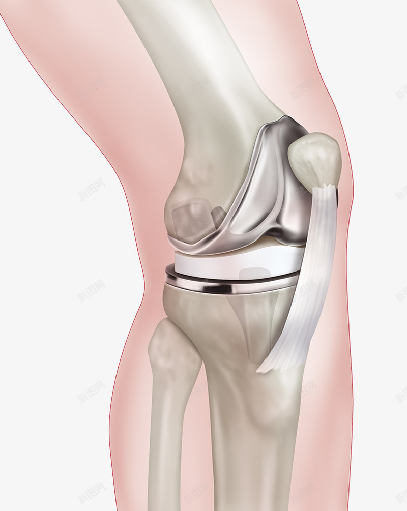 膝盖骨头结构png免抠素材_新图网 https://ixintu.com 人体结构 关节炎 膝盖 骨头